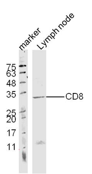 CD8 Rabbit Polyclonal Antibody