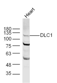 DLC1 Rabbit Polyclonal Antibody