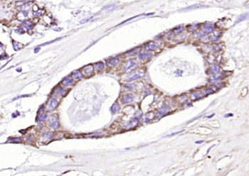 EpCAM Rabbit Polyclonal Antibody