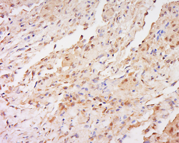 FAM166A Rabbit Polyclonal Antibody