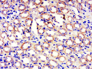 GRINA Rabbit Polyclonal Antibody