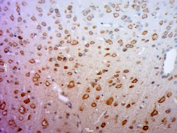 GLUT1 Rabbit Polyclonal Antibody