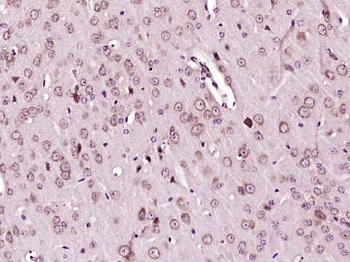 Histone binding protein/SLBP Rabbit Polyclonal Antibody