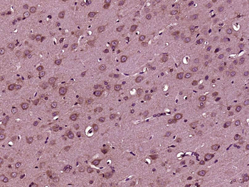 IGF 1 Rabbit Polyclonal Antibody