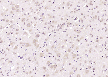 Importin 8 Rabbit Polyclonal Antibody