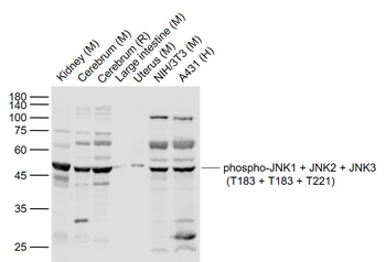 Phospho-JNK1 + JNK2 + JNK3 (T183 + T183 + T221) Rabbit Polyclonal Antibody