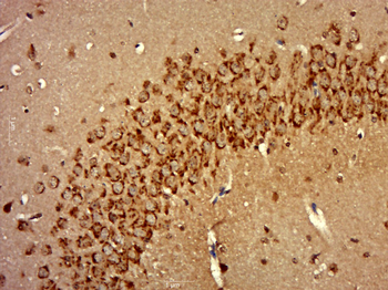 STMN1 Rabbit Polyclonal Antibody