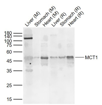 MCT1/Malignant T cell amplified sequence 1 Rabbit Polyclonal Antibody