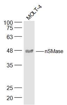 NSMase Rabbit Polyclonal Antibody