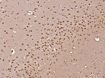 NSMCE4A Rabbit Polyclonal Antibody