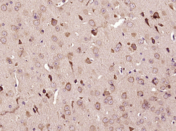 NFE2L1 Rabbit Polyclonal Antibody