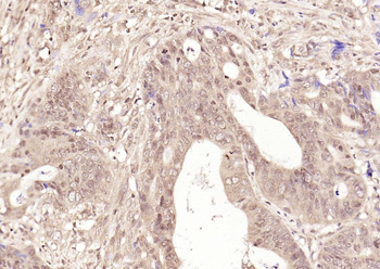 NFKB1 Rabbit Polyclonal Antibody