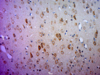 NrCAM Rabbit Polyclonal Antibody