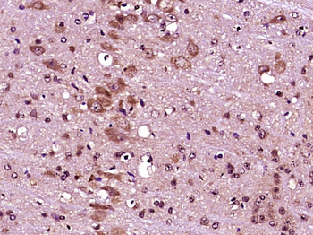 Olfactory Marker Protein Rabbit Polyclonal Antibody