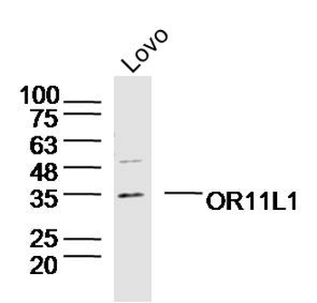 OR11L1 Rabbit Polyclonal Antibody