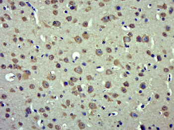RAB30 Rabbit Polyclonal Antibody