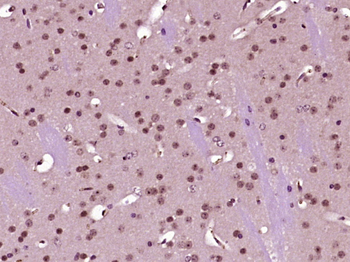 P66 alpha/GATAD2A Rabbit Polyclonal Antibody