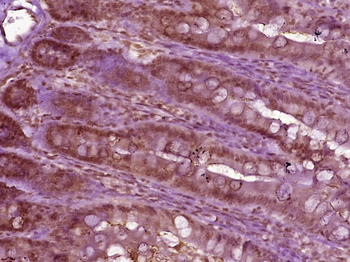 PRP18 homolog Rabbit Polyclonal Antibody