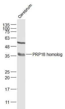 PRP18 homolog Rabbit Polyclonal Antibody