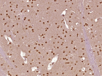 PRPF40B Rabbit Polyclonal Antibody