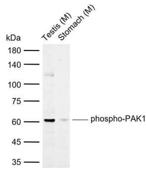Phospho-PAK3 (Ser154) Rabbit Polyclonal Antibody