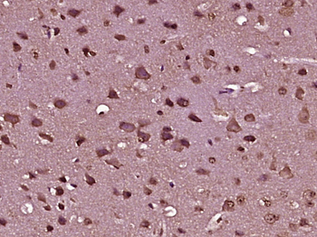 Prune homolog 2/C9orf65 Rabbit Polyclonal Antibody