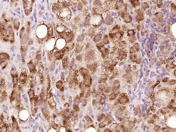 PSG4 Rabbit Polyclonal Antibody