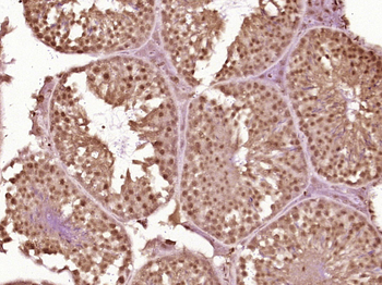 PSMC3IP Rabbit Polyclonal Antibody