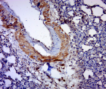 PSME1 Rabbit Polyclonal Antibody
