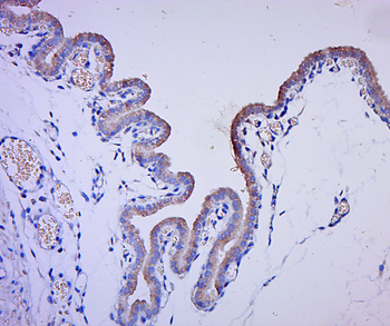 PSME2 Rabbit Polyclonal Antibody