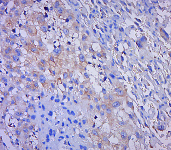 PSME2 Rabbit Polyclonal Antibody