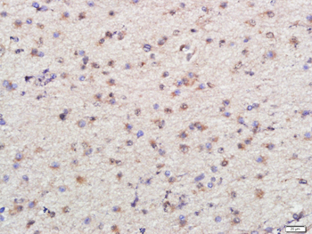 PSMG1 Rabbit Polyclonal Antibody