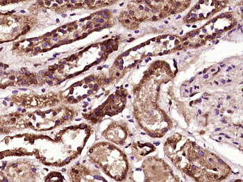 PTPD1 Rabbit Polyclonal Antibody