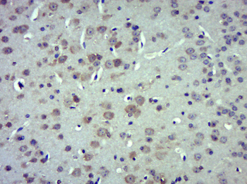 PREX1 Rabbit Polyclonal Antibody