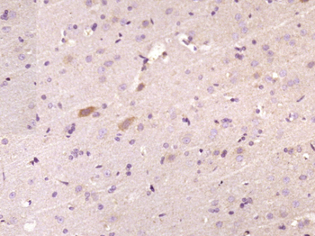 PXK Rabbit Polyclonal Antibody