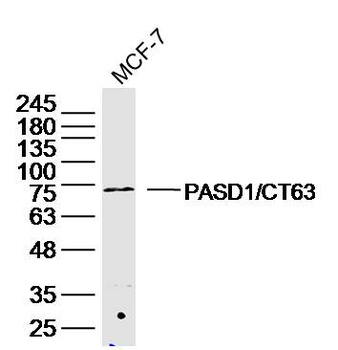 PASD1/CT63 Rabbit Polyclonal Antibody
