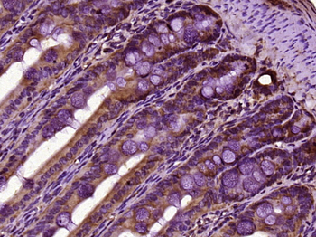 PATL2 Rabbit Polyclonal Antibody