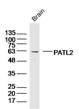 PATL2 Rabbit Polyclonal Antibody