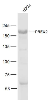 PREX2 Rabbit Polyclonal Antibody