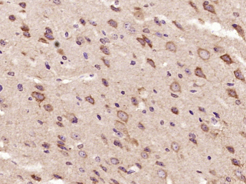 PPP2R2C Rabbit Polyclonal Antibody