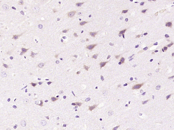 PPP2R2C Rabbit Polyclonal Antibody