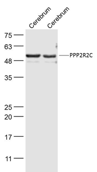 PPP2R2C Rabbit Polyclonal Antibody