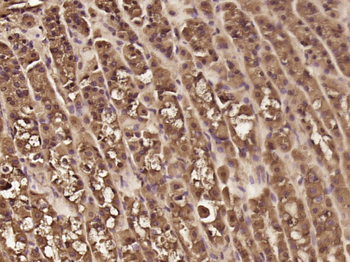PPP1R11 Rabbit Polyclonal Antibody