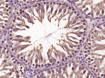 PACSIN2 Rabbit Polyclonal Antibody