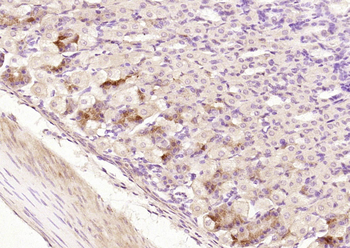 PLRP2 Rabbit Polyclonal Antibody