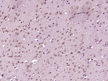 POU4F3 Rabbit Polyclonal Antibody