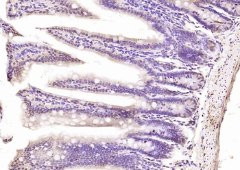 POU6F1/BRN5 Rabbit Polyclonal Antibody