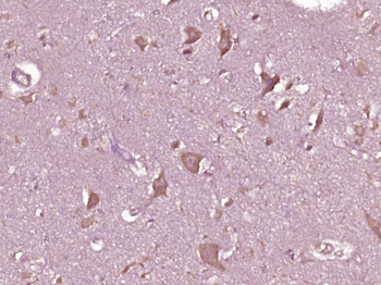 PPEF1 Rabbit Polyclonal Antibody