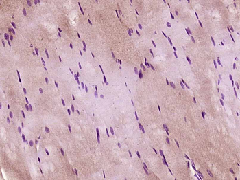 PECI Rabbit Polyclonal Antibody