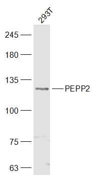 PEPP2 Rabbit Polyclonal Antibody